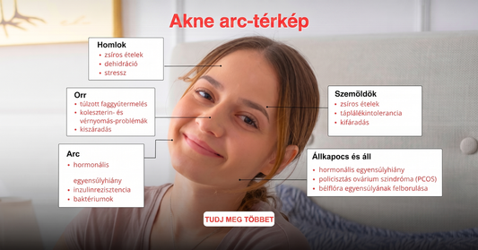 Akné arctérkép: pattanások az arc zónái szerint