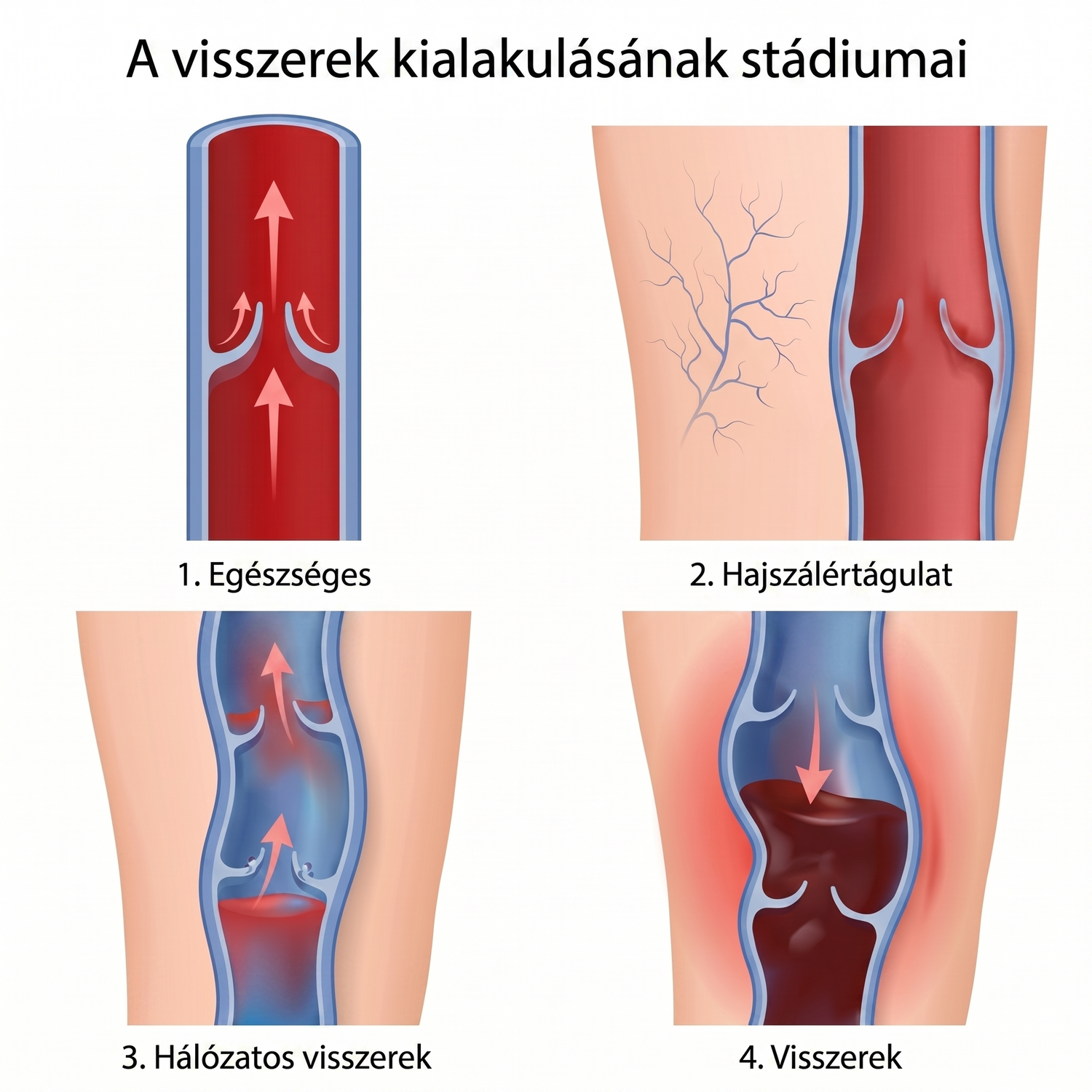 shutterstock_4stages