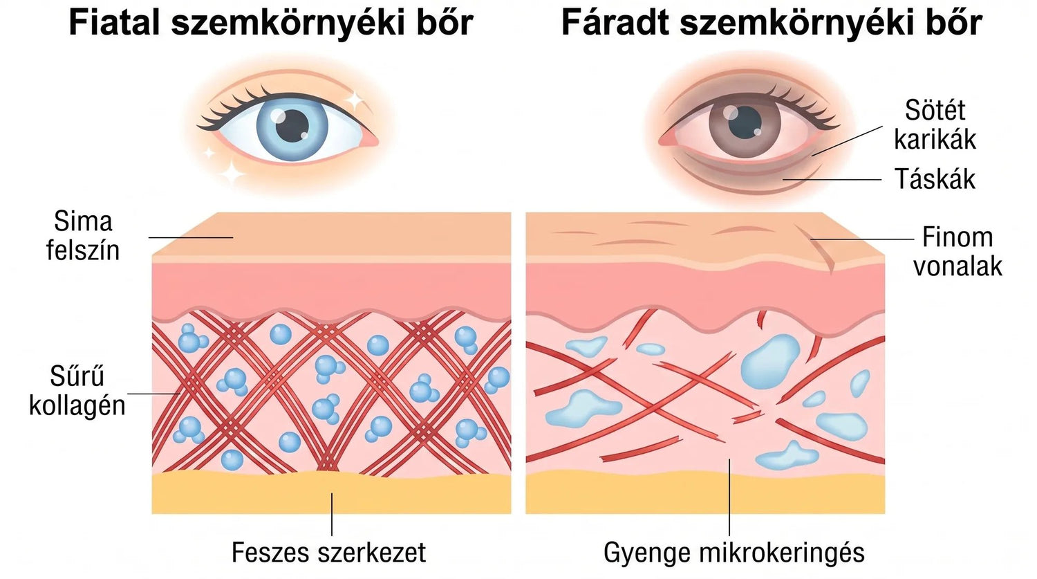 Rose Eye Lift HU eyev1
