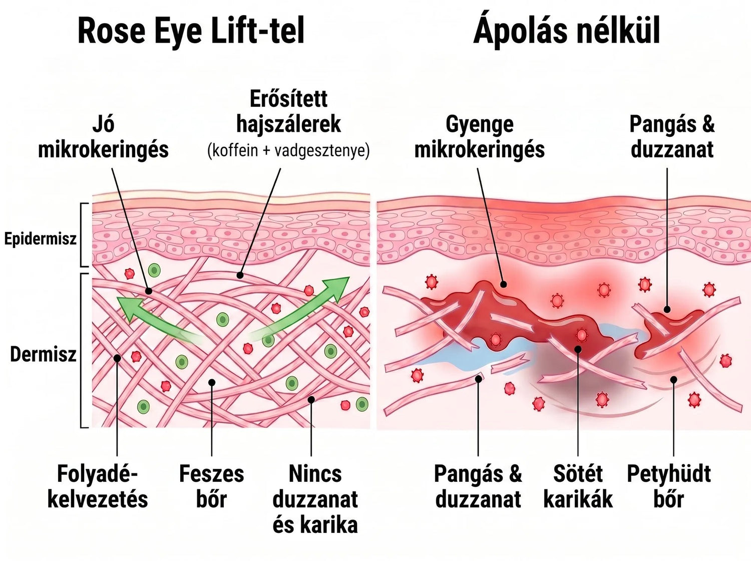 Rose Eye Lift HU t17